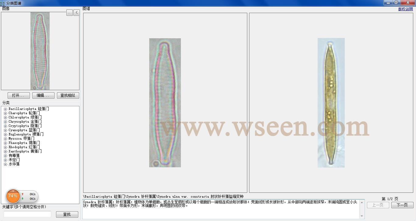 synedra ulna var. constracta 肘状针杆藻缢缩变种